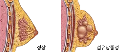 con1이미지