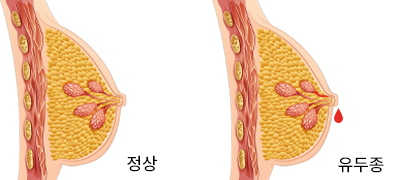 con1이미지